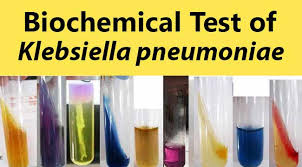 biochemical test and identification of klebsiella pneumoniae