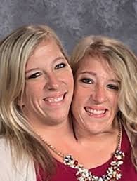 30 Interesting Things About Famous Conjoined Twins Abby And Brittany Hensel Page 30 Igcritic Com Conjoined Twins Human Oddities Tori Roloff