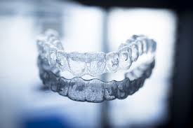 1 st year full time wear and 2 nd year only night time wear. Retainers After Braces Faq S Ping Hai Dds Marietta Georgia