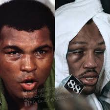 Muhammad Ali and Joe Frazier were both swollen, bruised and nearly-broken  after their third fight, "The Thrilla in Manila, 1975's "Fight of the Year"  for the heavyweight title in the Philippines. It's