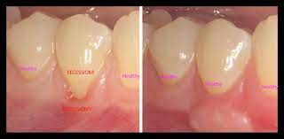 Cyndi is a passionate writer who writes about lifestyle tips on lifehack. Healthy Gums Healthy Life Tampa Fl Brian T Van Aelst