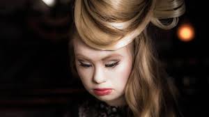 Some of the conditions that occur more. Madeline Stuart Model With Down Syndrome Becomes Ambassador For Social Inclusion Abc News