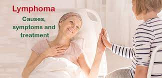 Symptoms, causes, diagnosis, treatment, and prevention. What Is Lenfoma Lymph Cancer Causes Symptoms And Treatment
