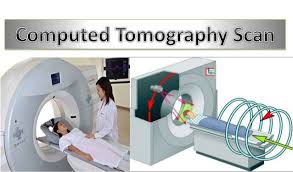 CT Scan (Computed Tomography) – What All Should You Know? - Omega PDS