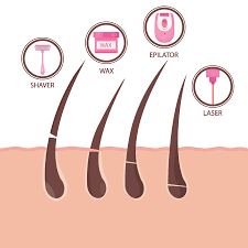 It is done by a dermatologist. 5 Questions To Ask Before Getting Laser Hair Removal Louisville Laser