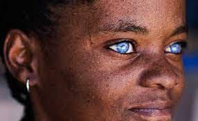 The Fallen The Nephilim And Us Alternative Before It S News People With Blue Eyes Change Your Eye Color Dark Skin Blue Eyes