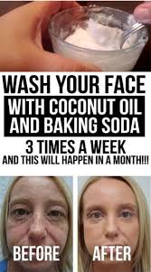Pin By Sharon Hug On Health And Wellness Tips Baking Soda Face Scrub Coconut Oil Face Wash Baking Soda Face