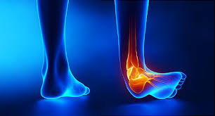 Pin On Foot Leg Pain