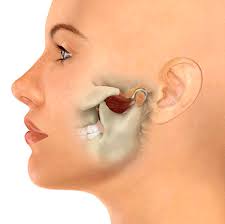 Image result for Jaw Dislocation