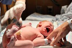 Do Newborns Really Need That Eye Ointment Childrensmd