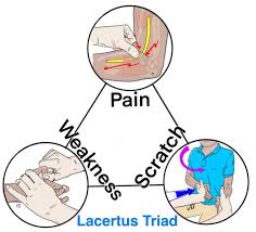 Image result for Carpal Compression Test