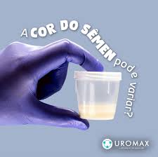 Você sabia que a cor do sêmen pode variar? - Uromax