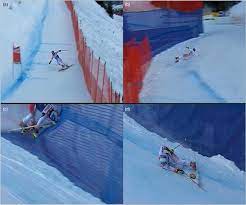 That is what skiing feels like. Injury Situation Leading To A Fracture Of The Tibia And Syndesmosis Download Scientific Diagram