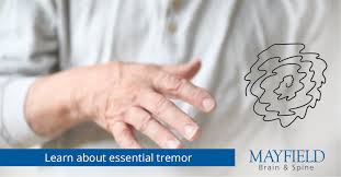 Image result for Essential Tremor