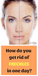 They can help you get rid of freckles fast and naturally. Pin By Funlola Lamidi On Home Remedies Brown Spots On Face Get Rid Of Freckles Brown Spots Removal