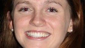 Marlins stay unbeaten in girls lacrosse