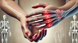 Día Mundial de la Artritis Reumatoidea: cómo el tratamiento oportuno mejora  la calidad de vida | Los Tiempos