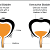 Overactive bladder, a urological syndrome. Https Encrypted Tbn0 Gstatic Com Images Q Tbn And9gctrw352lafdm6p6sjothpkk4tbz4lbgs3ncbkl9j3zlpj0 Qc1x Usqp Cau