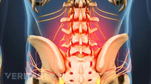 Feb 28, 2019 · although back pain is usually described as dull or aching, it can also feel sharp and stabbing. Is Your Lower Back Pain Serious Advanced Spine And Pain Clinic