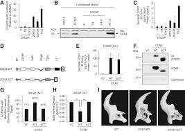 The hormones that your thyroid gland produces help regulate several of your bodily functions. Ccn3 Nephroblastoma Overexpressed Is A Functional Mediator Of Prostate Cancer Bone Metastasis That Is Associated With Poor Patient Prognosis The American Journal Of Pathology