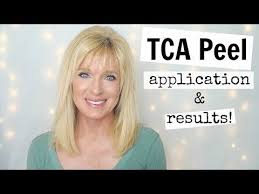 Pin On Skin Care