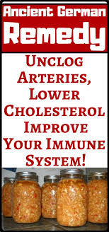 Ancient German Remedy That Will Unclog Arteries Lower Cholesterol And Improve Your Immune Sys Holistic Health Remedies Natural Health Remedies Health Remedies