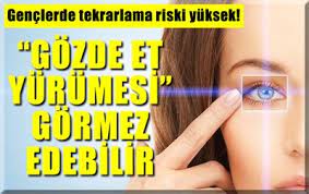 Gozde Et Yurumesi Gormez Edebilir Www Marasposta Com