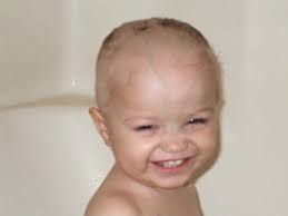 Jett's cancer: desmoplastic medulloblastoma