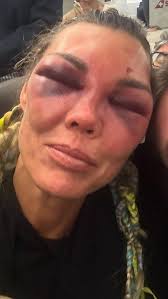 Boxning: Mikaela Laurén gör comeback – blir Sveriges äldsta proffsboxare genom tiderna