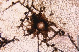 Image result for Uncinula necator