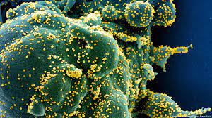 Undervalued in many places before 2020, systems for. Coronavirus Latest Who Defends Its Covid 19 Response News Dw 29 04 2020