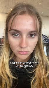 Whats A Vertical Wink