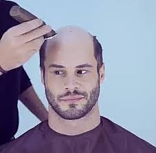 Know anyone who could do with one of these pieces...? 😱👇 OneHead