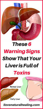 Pin By Cathy F On No Limit Advertising Natural Healing Natural Healing Remedies Remedies