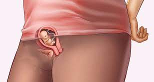 We did not find results for: 7 Weeks Pregnant 7 Weeks Pregnant Symptoms Baby At 7 Weeks Huggies India