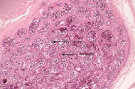 Both types of bone marrow are enriched with blood vessels and capillaries. Description