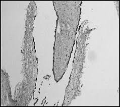 We did not find results for: Peritoneal Benign Mesothelioma During And After Two Pregnancies European Journal Of Obstetrics And Gynecology And Reproductive Biology
