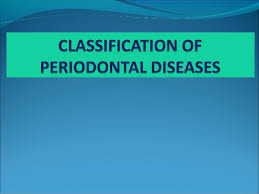 classification of periodontal diseases