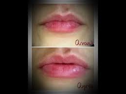 Without going through the box injection can now cheat with impunity on its size and afford the mouth of his dreams. Augmenter Le Volume De Ses Levres Sans Chirurgie Et Gratuitement Youtube