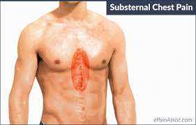Substernal Chest Pain Causes Symptoms Treatment Diagnosis