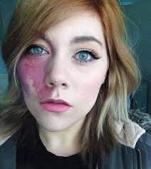 Unique people That Show How Unpredictable Genetics Can Be