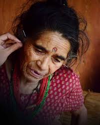 Acupuncture Relief Project