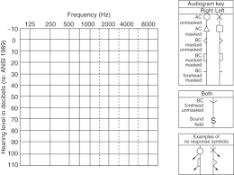 Image result for Whispered Voice Testing