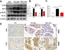 Maybe you would like to learn more about one of these? Asiaticoside Ameliorates Acinar Cell Necrosis In Acute Pancreatitis Via Toll Like Receptor 4 Pathway Sciencedirect