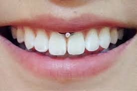 Smiley Piercing Commonly Asked Questions Before Getting One In 2020 Smiley Piercing Mouth Piercings Frenulum Piercing