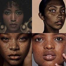 Image result for Freckled skin
