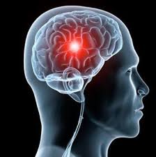 Check spelling or type a new query. Trombosis Cerebral Al Dia Posts Facebook