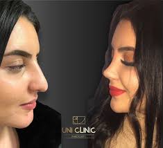 unirhinoplstayclinic (@unirhinoplstayclinic) · Istanbul
