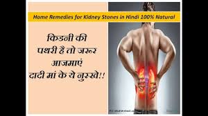 Kidneystones Homeremediesforkidneystone Kidneystonekeupay क डन क पथर ह त जर र आजम ए द द म Kidney Stones Remedy Eye Sight Improvement Health Advice