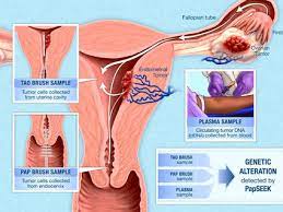 At age 52 the amount of estrogen an ovary produces is typically small. Closer Look At Postmenopausal Bleeding And Endometrial Cancer National Cancer Institute